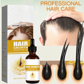 Масло для роста волос для мужчин Biotin Сыворотка для быстрого лечения облысения
